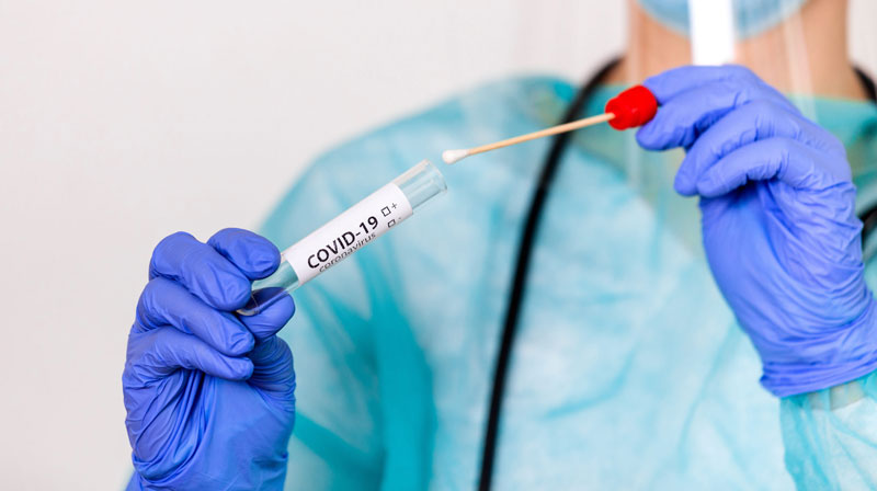Aplican en Camagüey test rápido de antígeno para detectar el SARS-CoV-2 