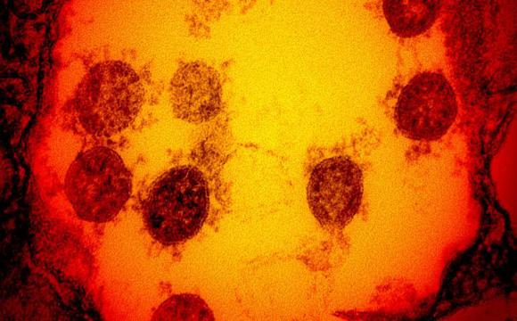 Una mutación ha hecho que el coronavirus sea ocho veces más infeccioso que la cepa de Wuhan